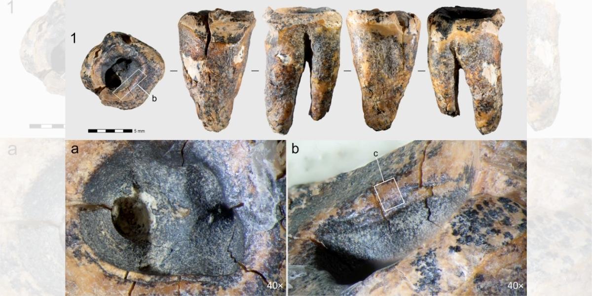 Neanderthal teeth